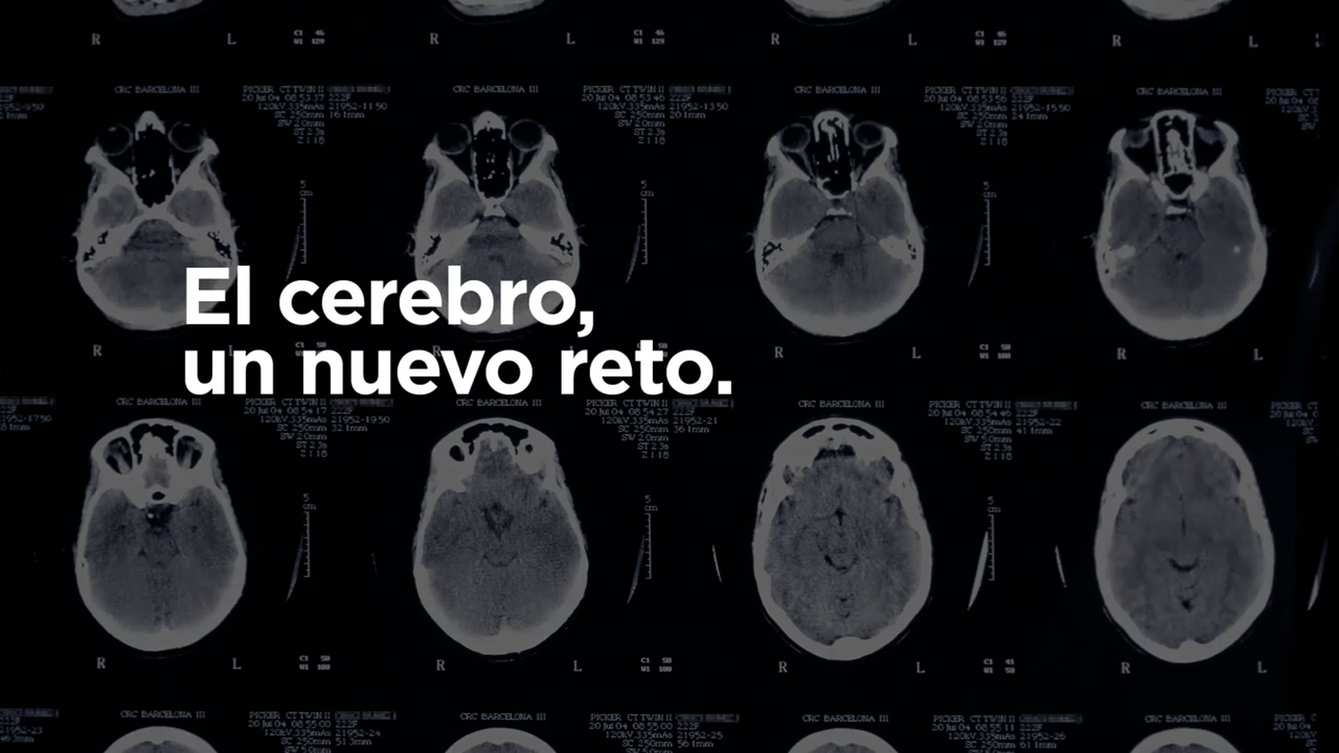 El cerebro un nuevo reto